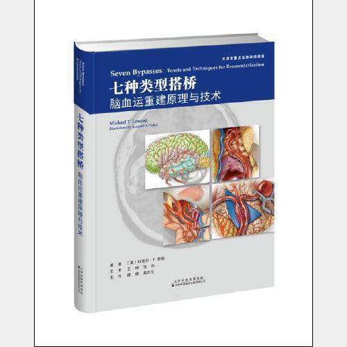 七种类型搭桥：脑血运重建原理与技术