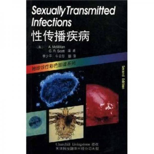 性传播疾病