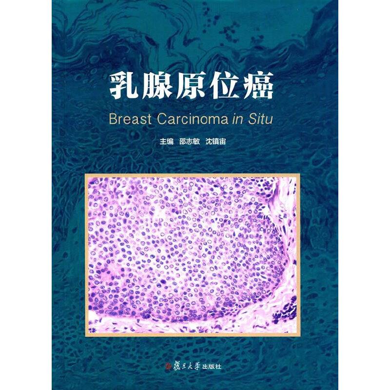 乳腺原位癌
