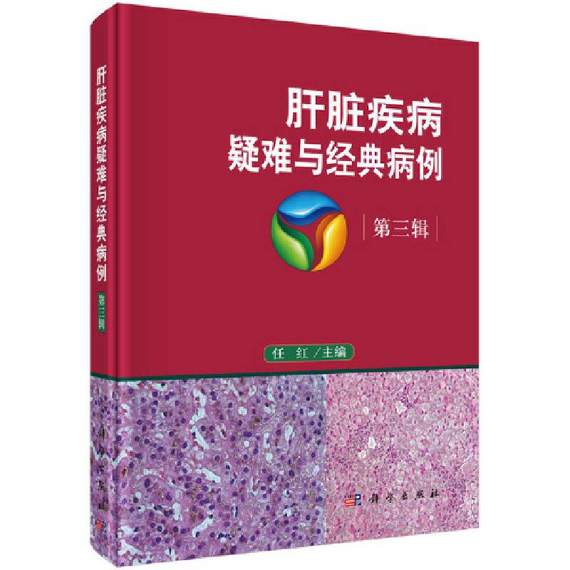 肝脏疾病疑难与经典病例  第三辑
