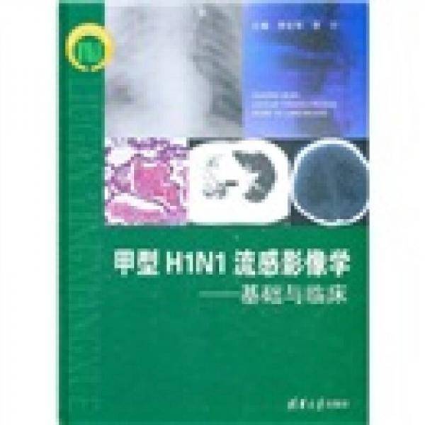 甲型H1N1流感影像学