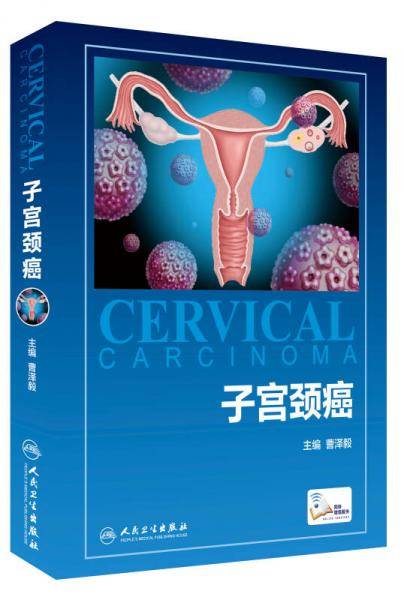 子宫颈癌（网络增值服务）