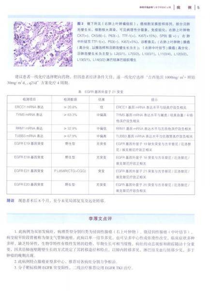 肺癌早期诊断与多学科治疗示例