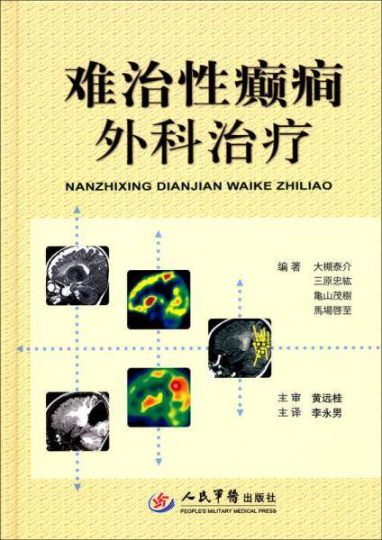 难治性癫痫外科治疗