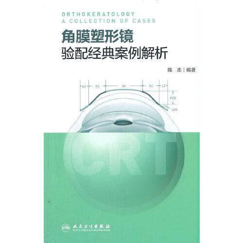 角膜塑形镜验配经典案例解析