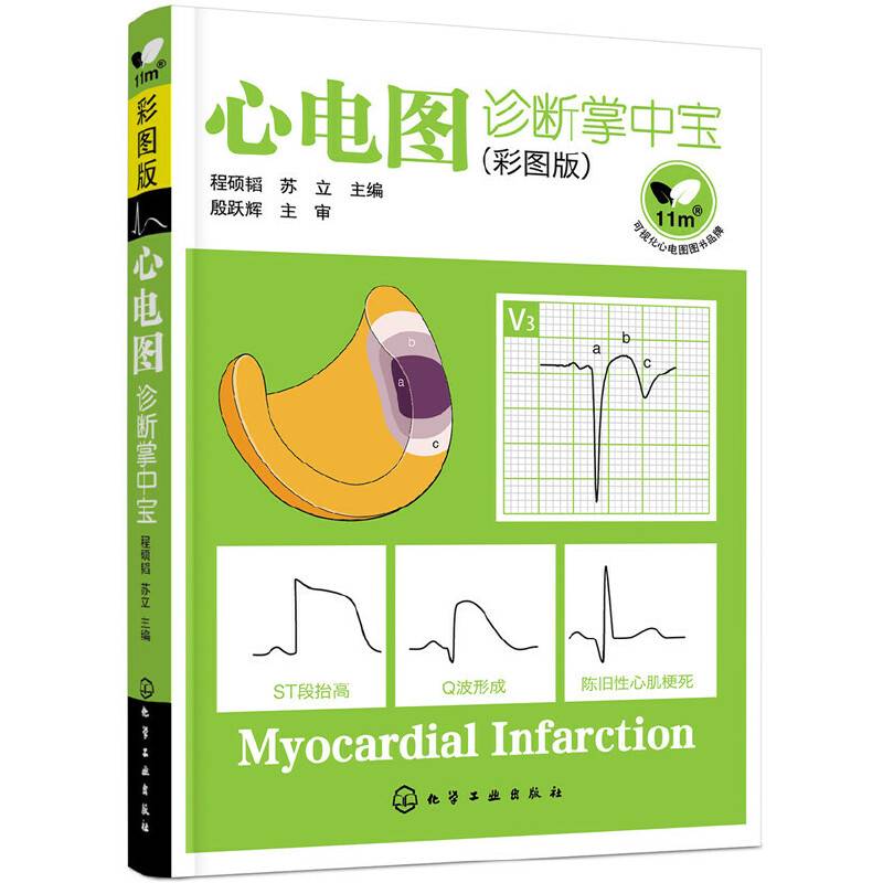心电图诊断掌中宝
