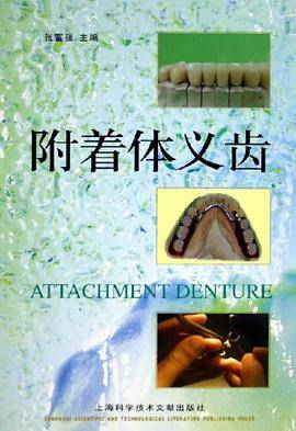 附着体义齿