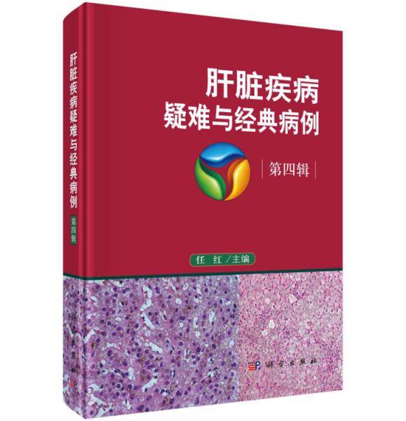 肝脏疾病疑难与经典病例  第四辑