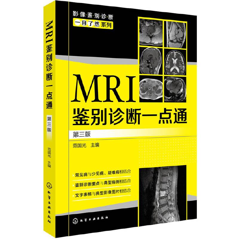 影像鉴别诊断一目了然系列--MRI鉴别诊断一点通（第三版）