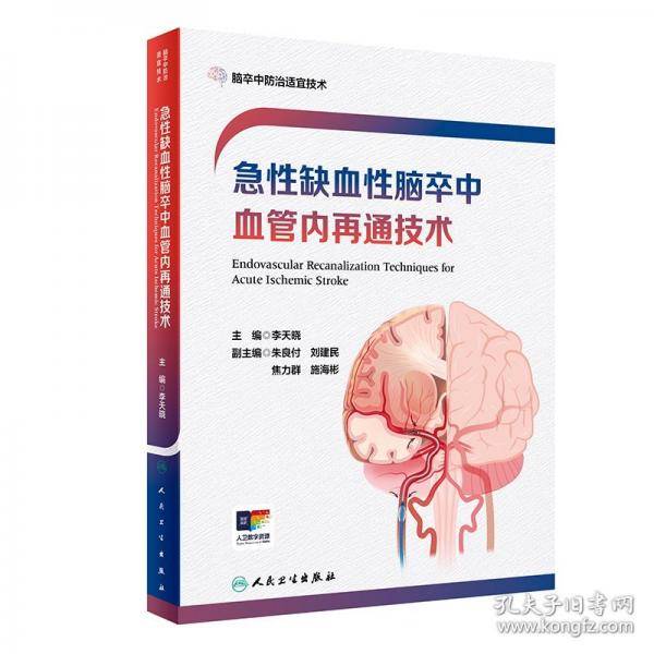 急性缺血性脑卒中血管内再通技术