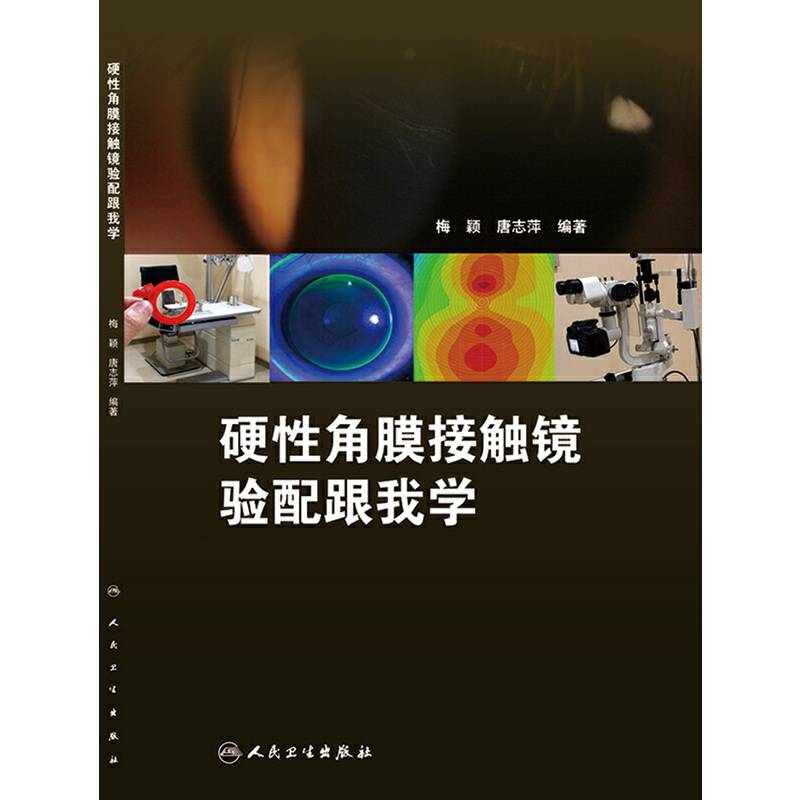 硬性角膜接触镜验配跟我学