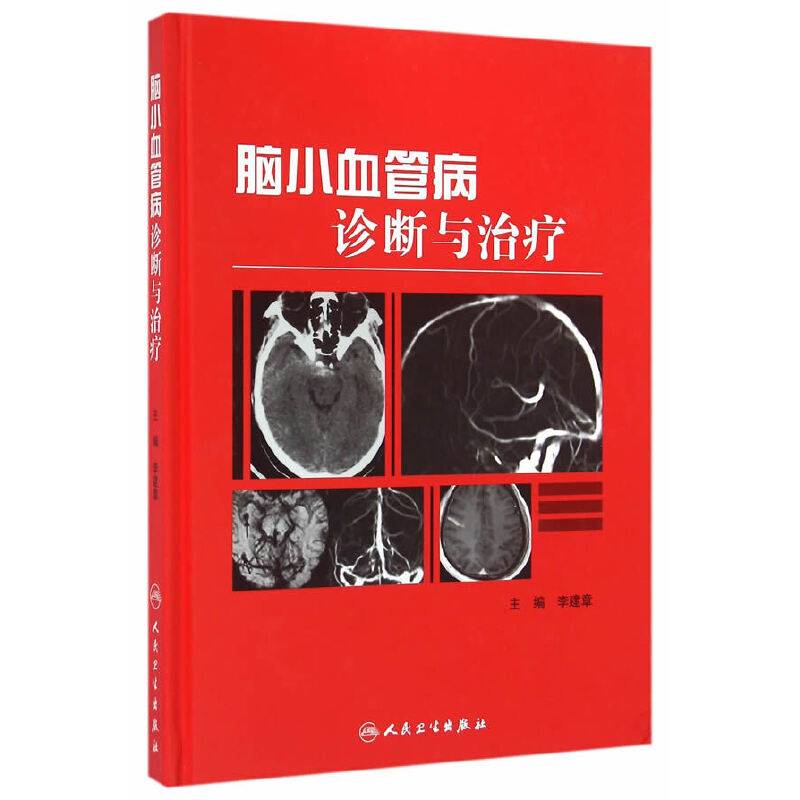 脑小血管病诊断与治疗