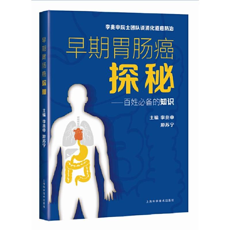 早期胃肠癌探秘--百姓必备的知识