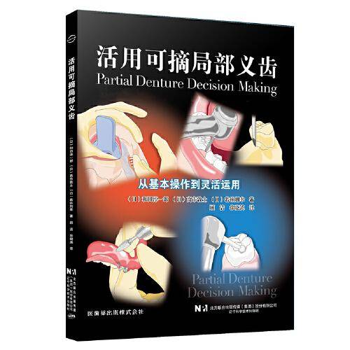 活用可摘局部义齿