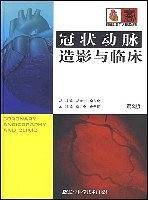 冠状动脉造影与临床