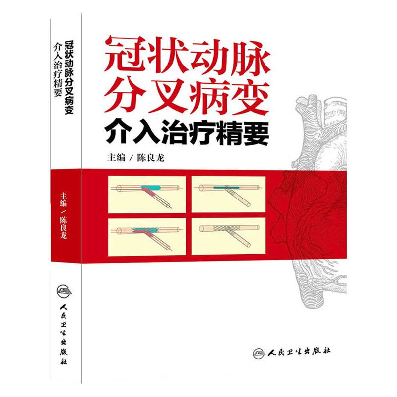 冠状动脉分叉病变介入治疗精要