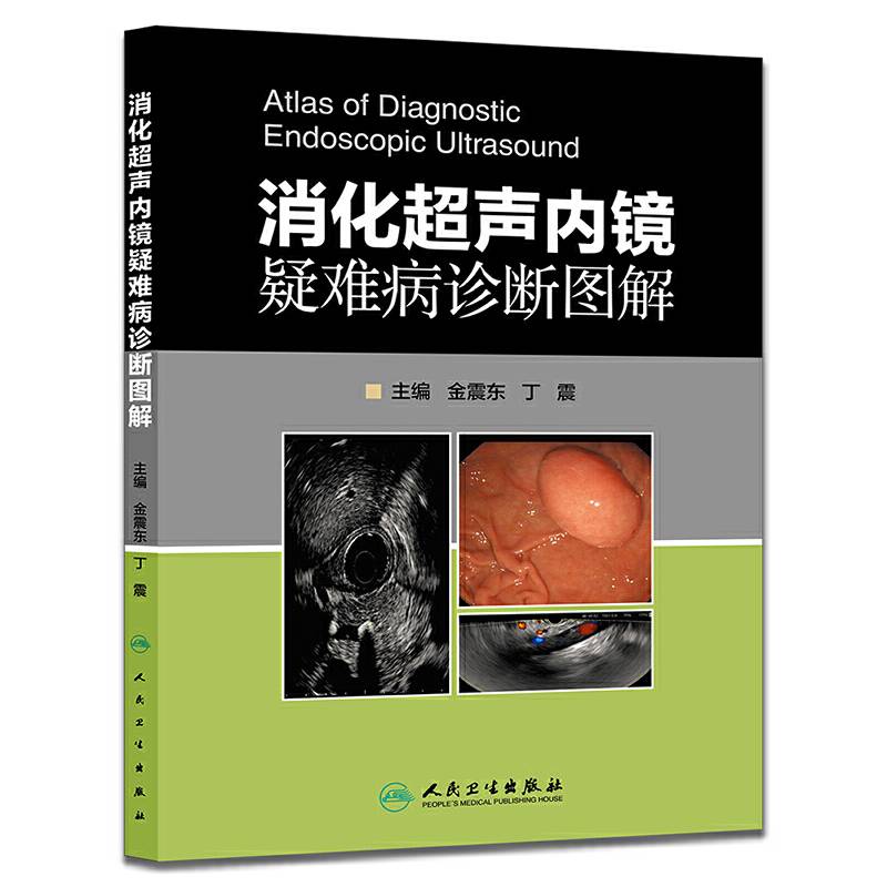 消化超声内镜疑难病诊断图解