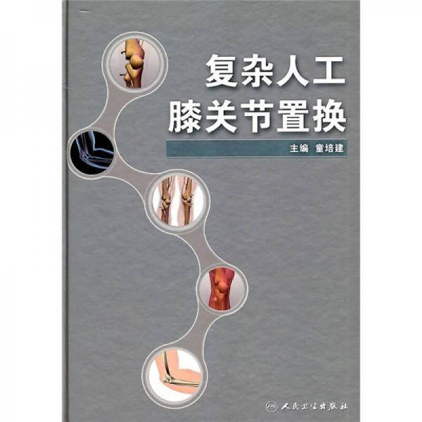 复杂人工膝关节置换