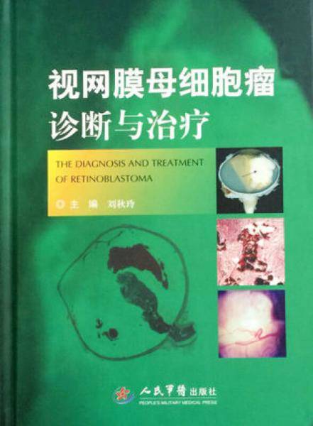 视网膜母细胞瘤诊断与治疗
