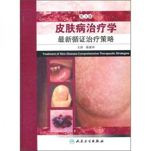 皮肤病治疗学