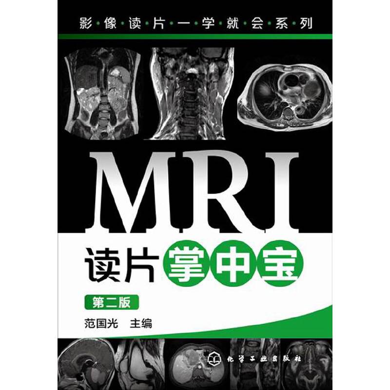 MRI读片掌中宝