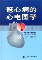 冠心病的心电图学