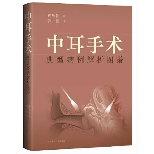 中耳手术典型病例解析图谱
