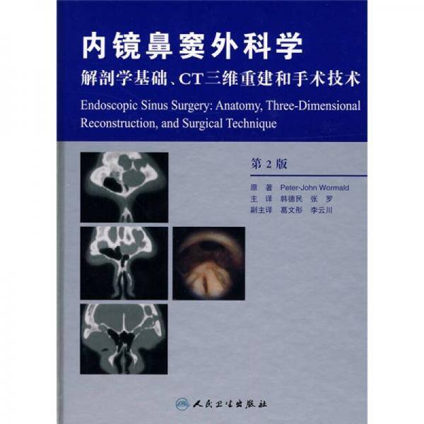 内镜鼻窦外科学