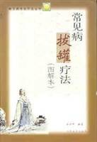 常见病拔罐疗法