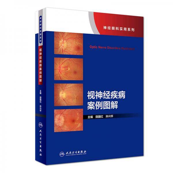 神经眼科实用系列：视神经疾病案例图解