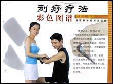 刮痧疗法彩色图谱