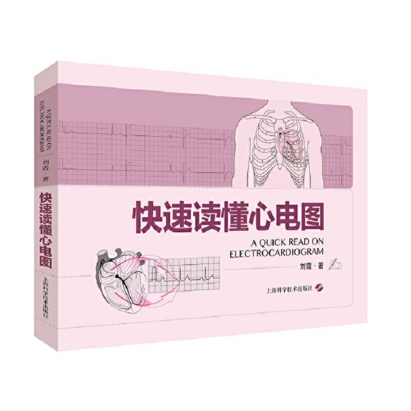 快速读懂心电图