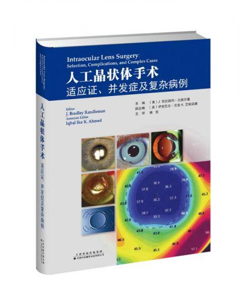 人工晶状体手术(适应证并发症及复杂病例)(精)