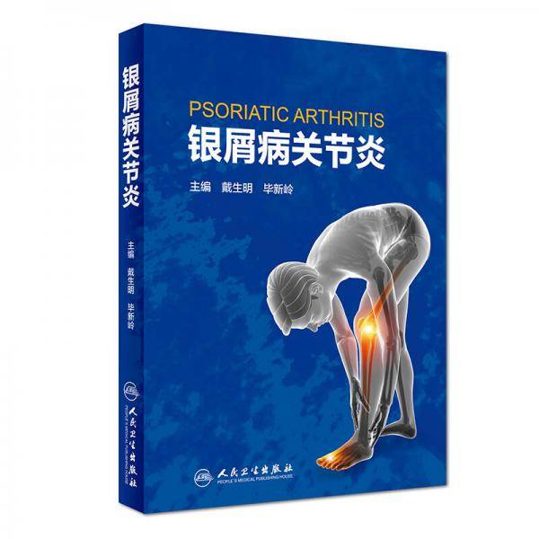 银屑病关节炎