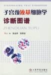 子宫颈液基细胞学诊断图谱