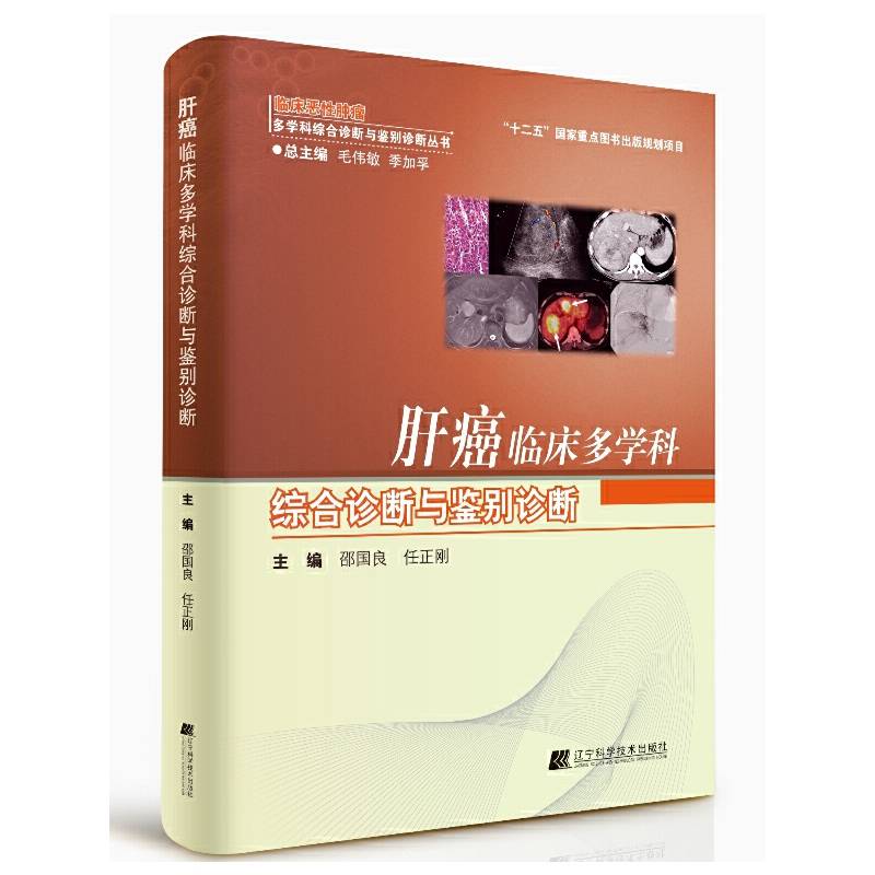 肝癌临床多学科综合诊断与鉴别诊断