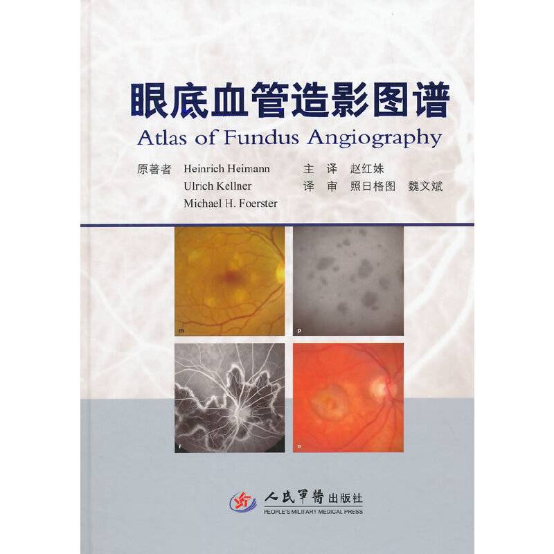 眼底血管造影图谱