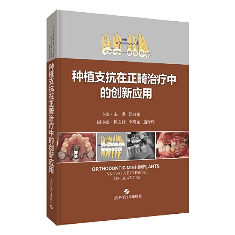 种植支抗在正畸治疗中的创新应用