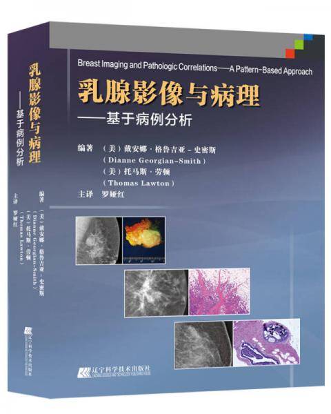 乳腺影像与病理——基于病例分析