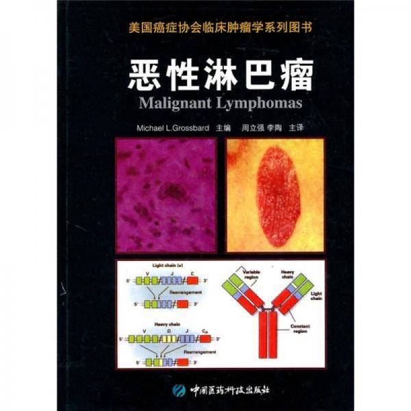 恶性淋巴瘤