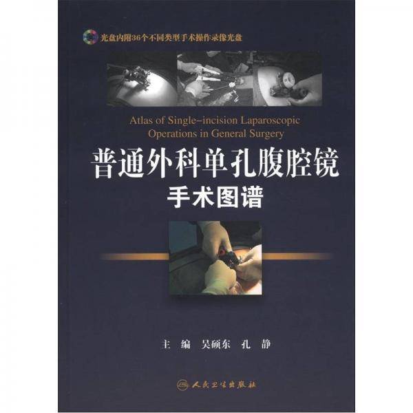 普通外科单孔腹腔镜手术图谱