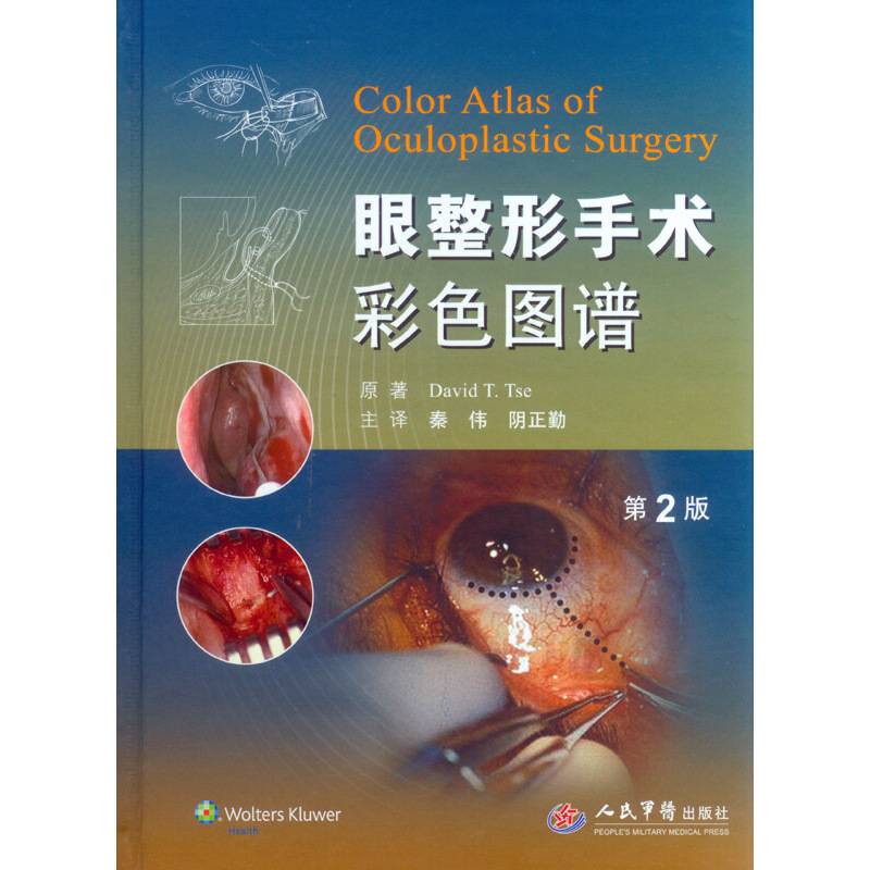 眼整形手术彩色图谱(第二版)