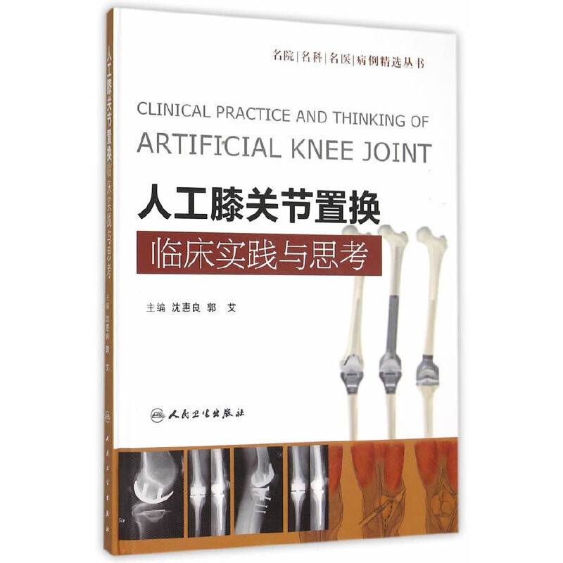 人工膝关节置换临床实践与思考