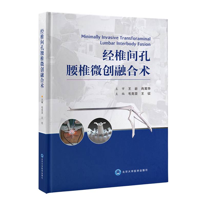 经椎间孔腰椎微创融合术