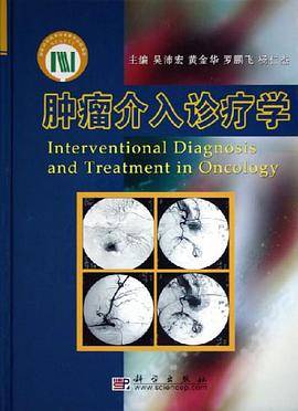 肿瘤介入诊疗学