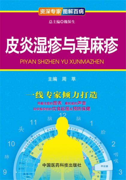 皮炎湿疹与荨麻疹