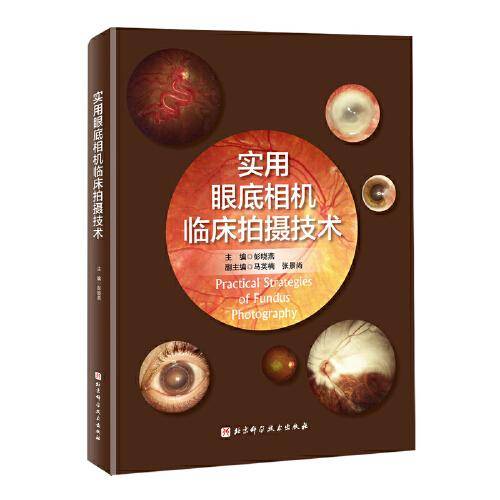实用眼底相机临床拍摄技术