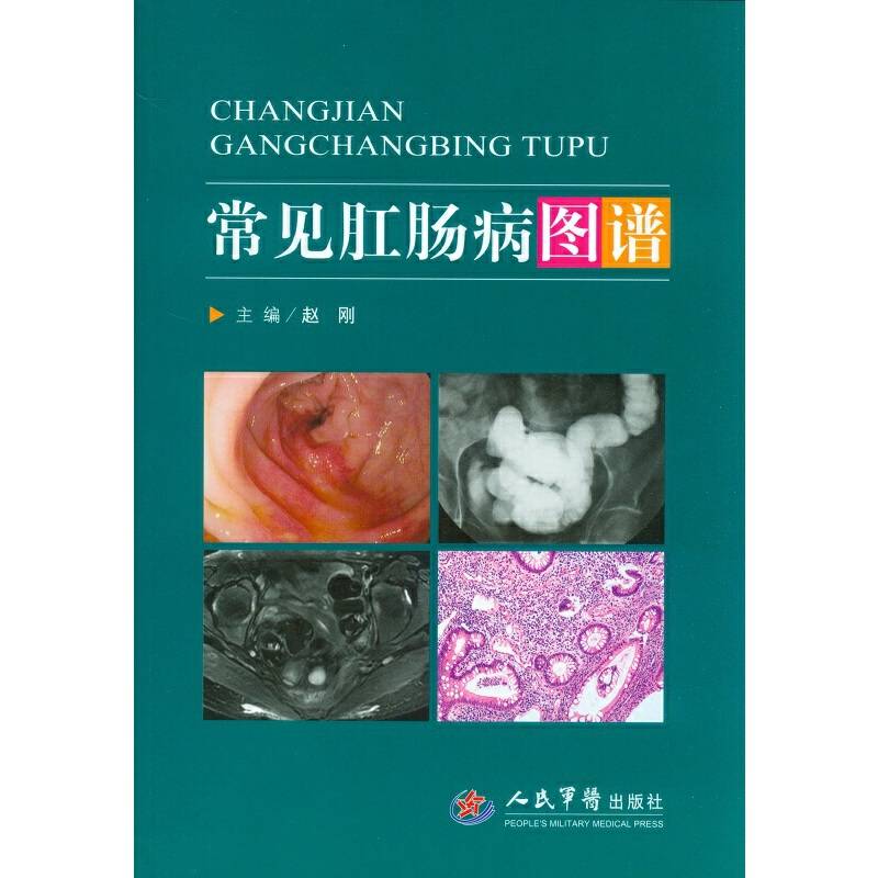 常见肛肠病图谱