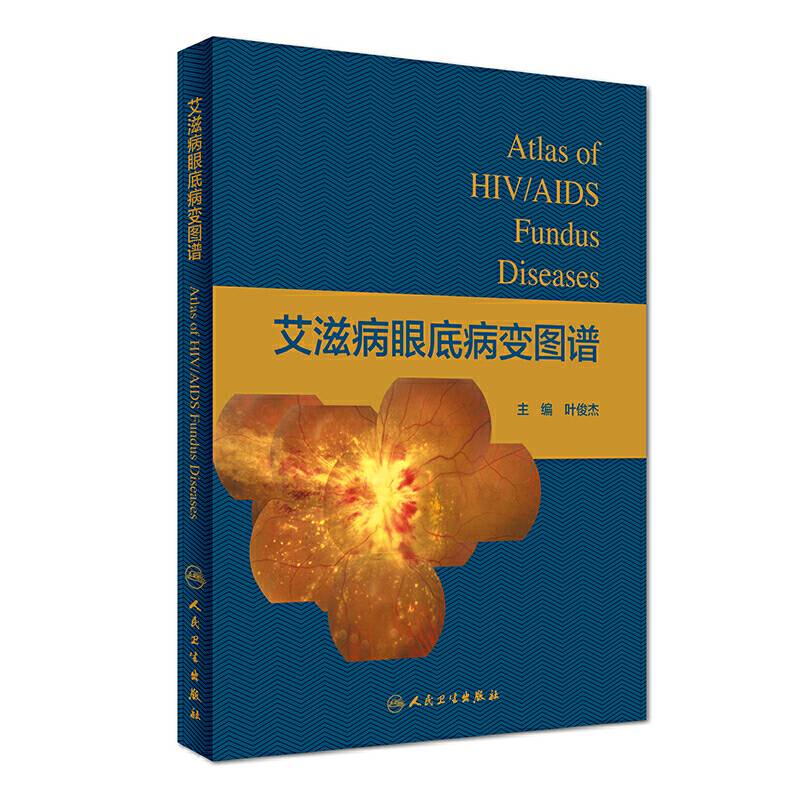 艾滋病眼底病变图谱