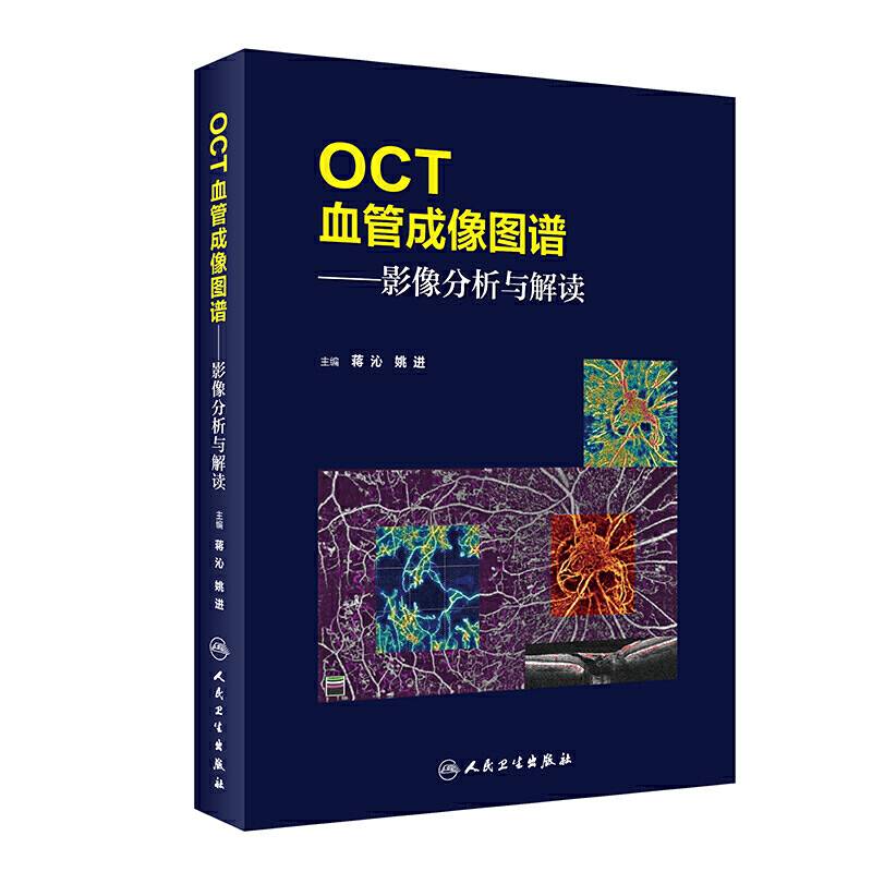 OCT血管成像图谱・影像分析与解读